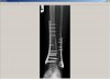 X-Ray 060812.jpg