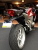After Fender Reduction Surgery.jpg