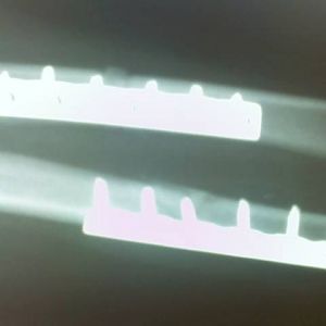 After surgery...