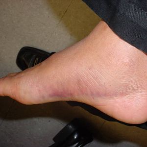 Jacky_foot1