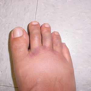 Jacky_foot2