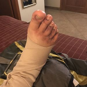 D5 Ankle Wrap