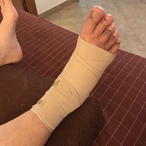 D5 Ankle Rewrap